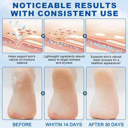 60% Urea 2% Salicylic Acid Foot Stick Cracked Repair Product Exfoliation Dead Skin Removal Softening Moisturize Smooth Skin Care