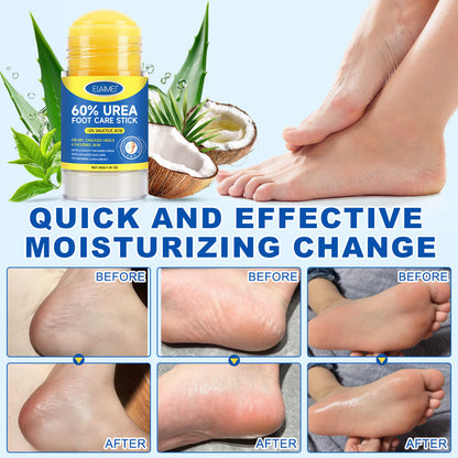 60% Urea 2% Salicylic Acid Foot Stick Cracked Repair Product Exfoliation Dead Skin Removal Softening Moisturize Smooth Skin Care