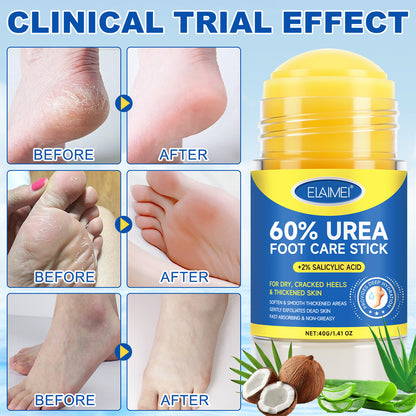 60% Urea 2% Salicylic Acid Foot Stick Cracked Repair Product Exfoliation Dead Skin Removal Softening Moisturize Smooth Skin Care