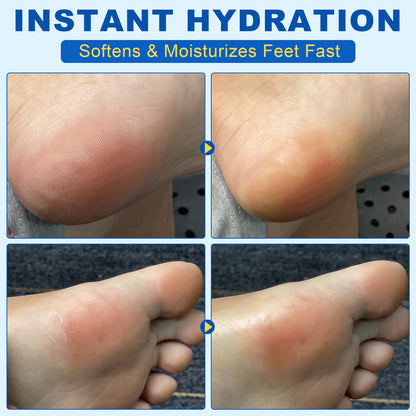 60% Urea 2% Salicylic Acid Foot Stick Cracked Repair Product Exfoliation Dead Skin Removal Softening Moisturize Smooth Skin Care
