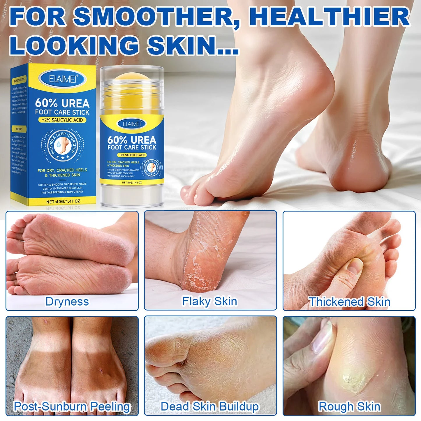 60% Urea 2% Salicylic Acid Foot Stick Cracked Repair Product Exfoliation Dead Skin Removal Softening Moisturize Smooth Skin Care