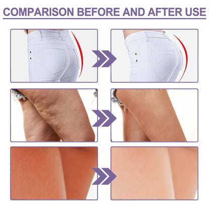Hip Lifting Soap Buttock Enlargement Anti Cellulite Shaping Butt Brightening Soap