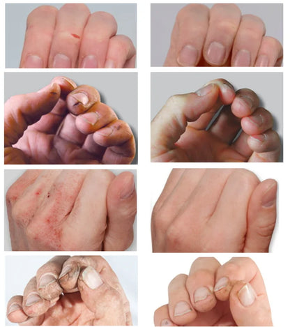 60% Urea 2% Salicylic Acid Foot Stick Cracked Repair Product Exfoliation Dead Skin Removal Softening Moisturize Smooth Skin Care