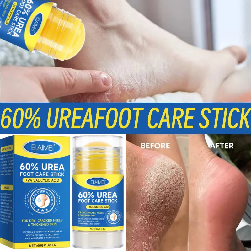 60% Urea 2% Salicylic Acid Foot Stick Cracked Repair Product Exfoliation Dead Skin Removal Softening Moisturize Smooth Skin Care