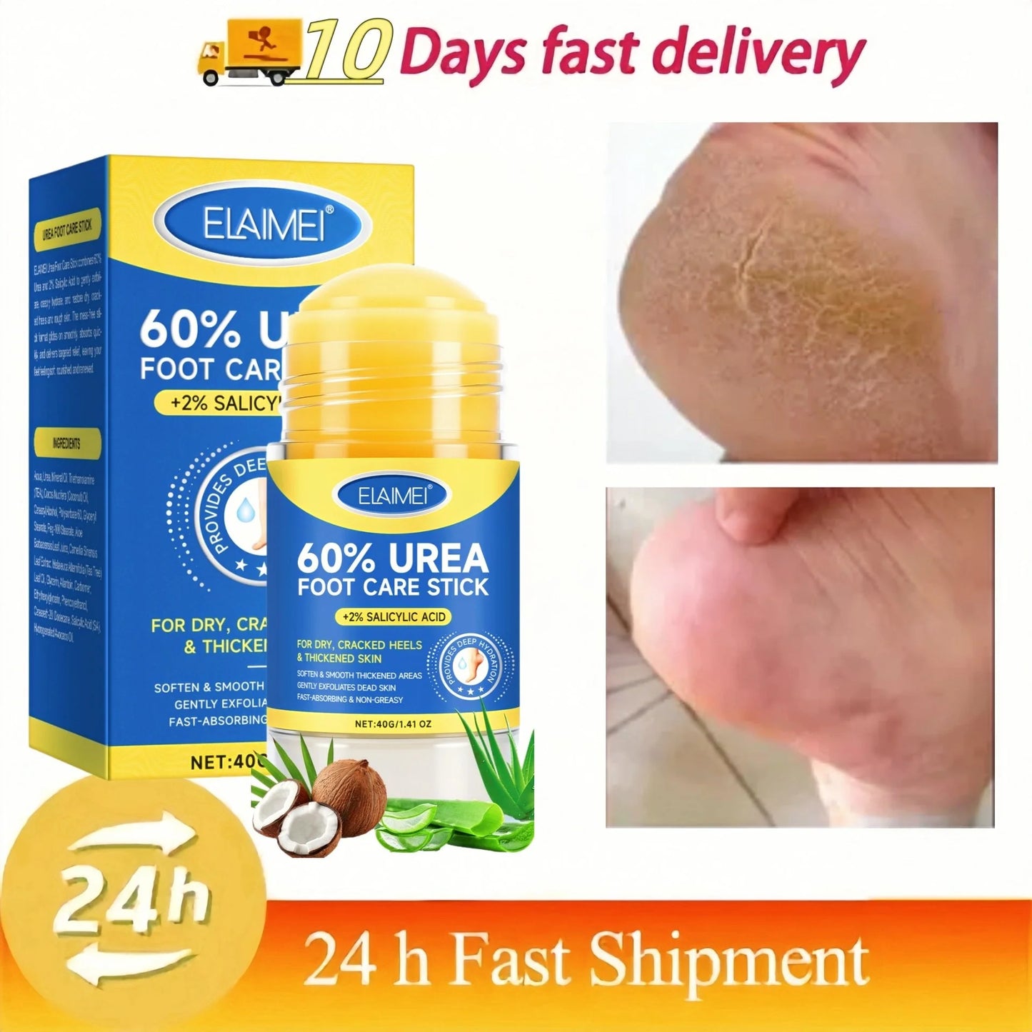 60% Urea 2% Salicylic Acid Foot Stick Cracked Repair Product Exfoliation Dead Skin Removal Softening Moisturize Smooth Skin Care