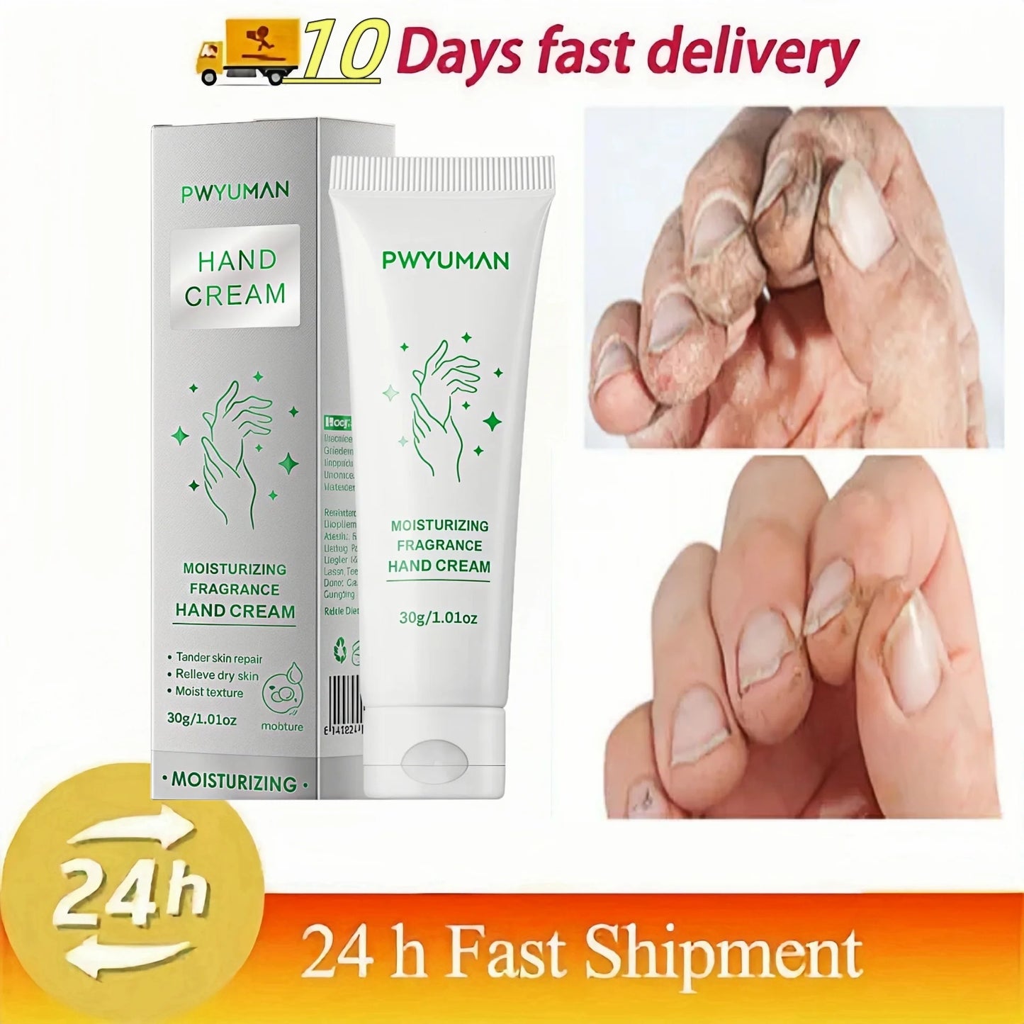 60% Urea 2% Salicylic Acid Foot Stick Cracked Repair Product Exfoliation Dead Skin Removal Softening Moisturize Smooth Skin Care