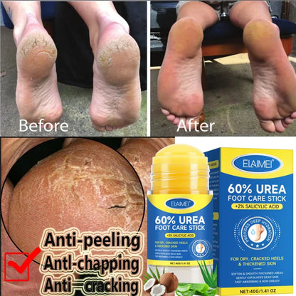 60% Urea 2% Salicylic Acid Foot Stick Cracked Repair Product Exfoliation Dead Skin Removal Softening Moisturize Smooth Skin Care